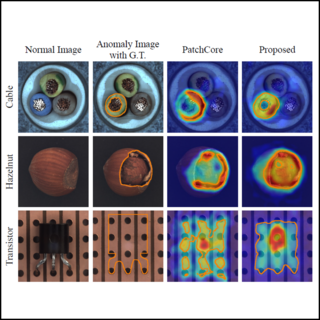PNI Anomaly Detection Teaser